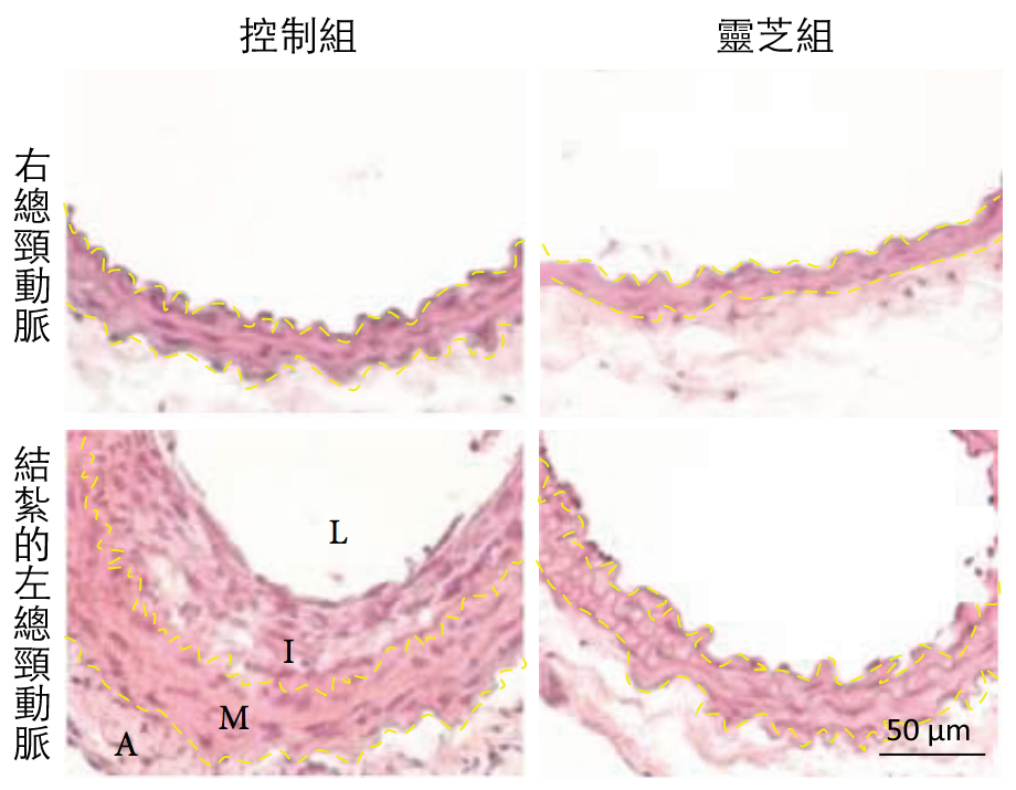 20180411-2